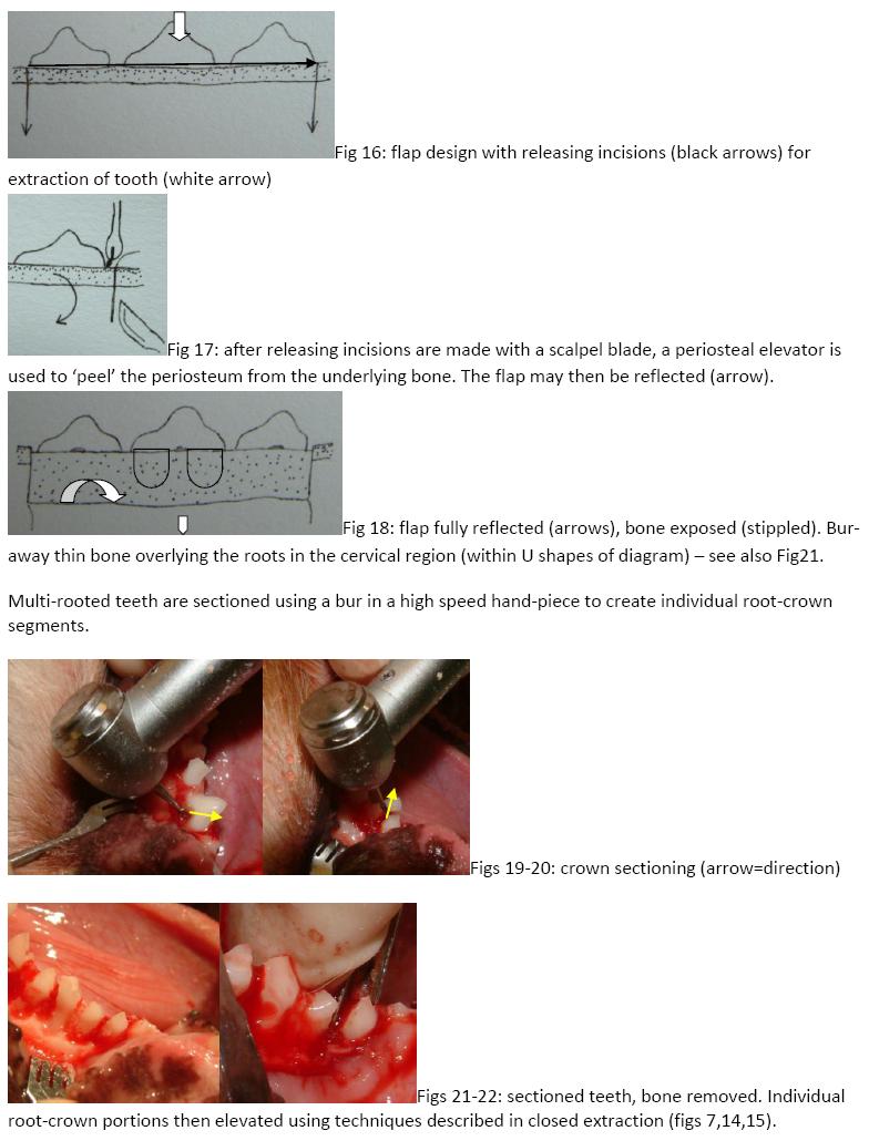 figure 16 - 22 - surgical extraction