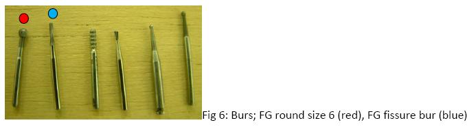 figure 6 - burs; FG round size 6 (red) and FG fissure bur (blue)